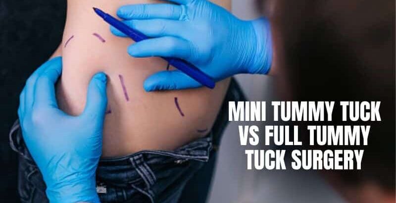 What’S The Difference Between A Full And Mini Tummy Tuck? – JEICN