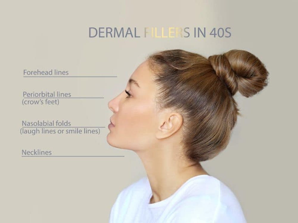 belotero dermal fillers belotero dermal fillers