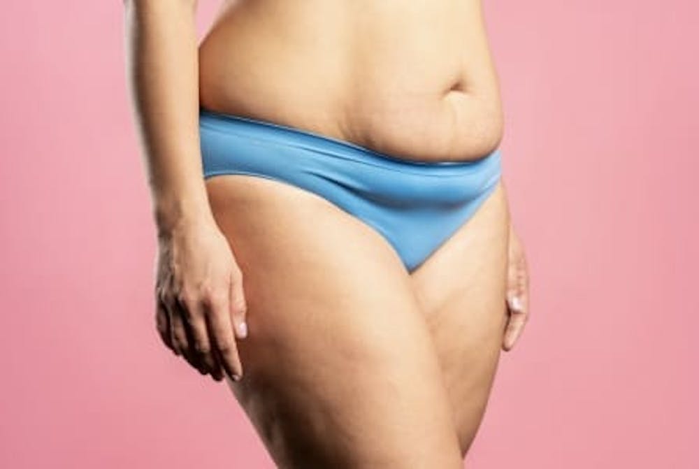 how to tighten stomach skin