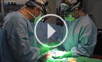 Removal of Infected Groin Mesh video