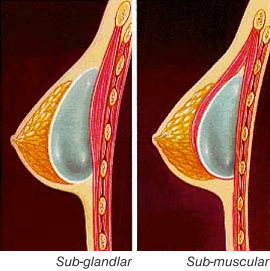 Breast diagram