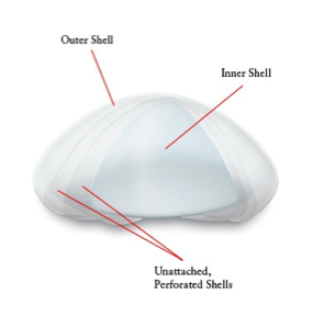 ideal implant diagram