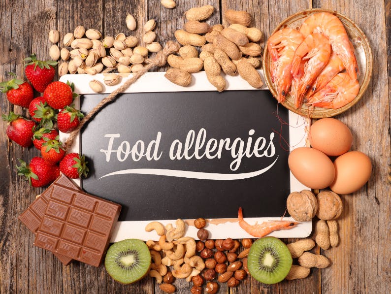 food allergies banner