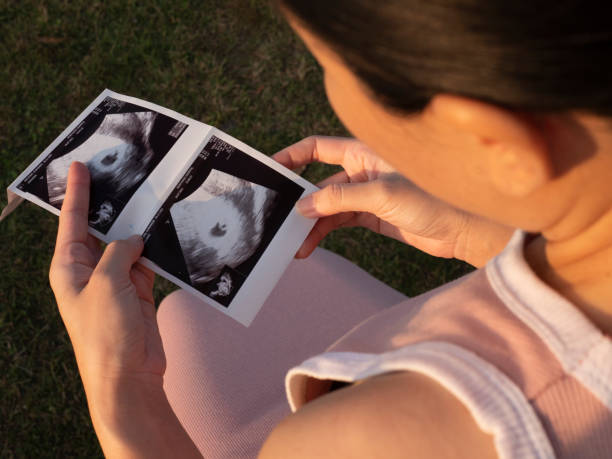 Woman looking at ultra sound pictures