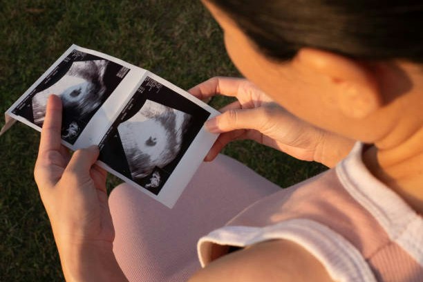 Schwangerschaft Hero Image Woman looking at ultra sound pictures