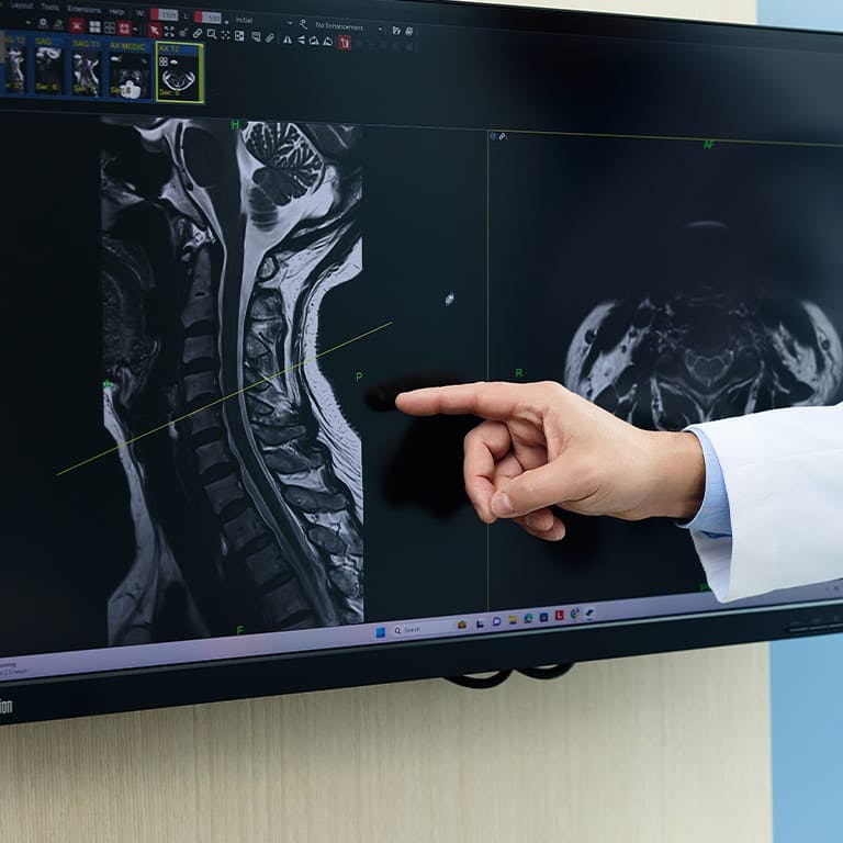 doctor pointing at an x-ray