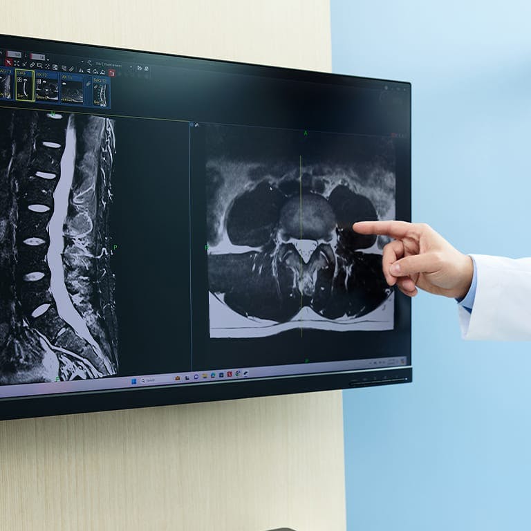 doctor pointing at x-rays