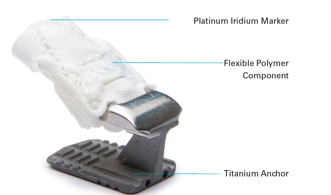 Barricaid Annular Closure Device