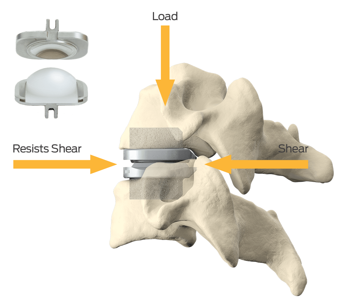 Prodisc-C
