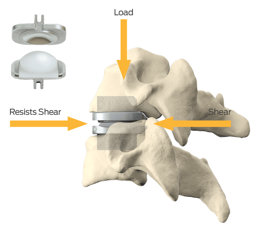 spine infographic