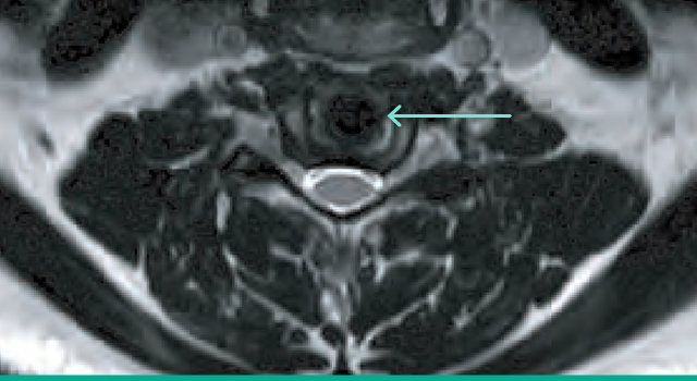 xray