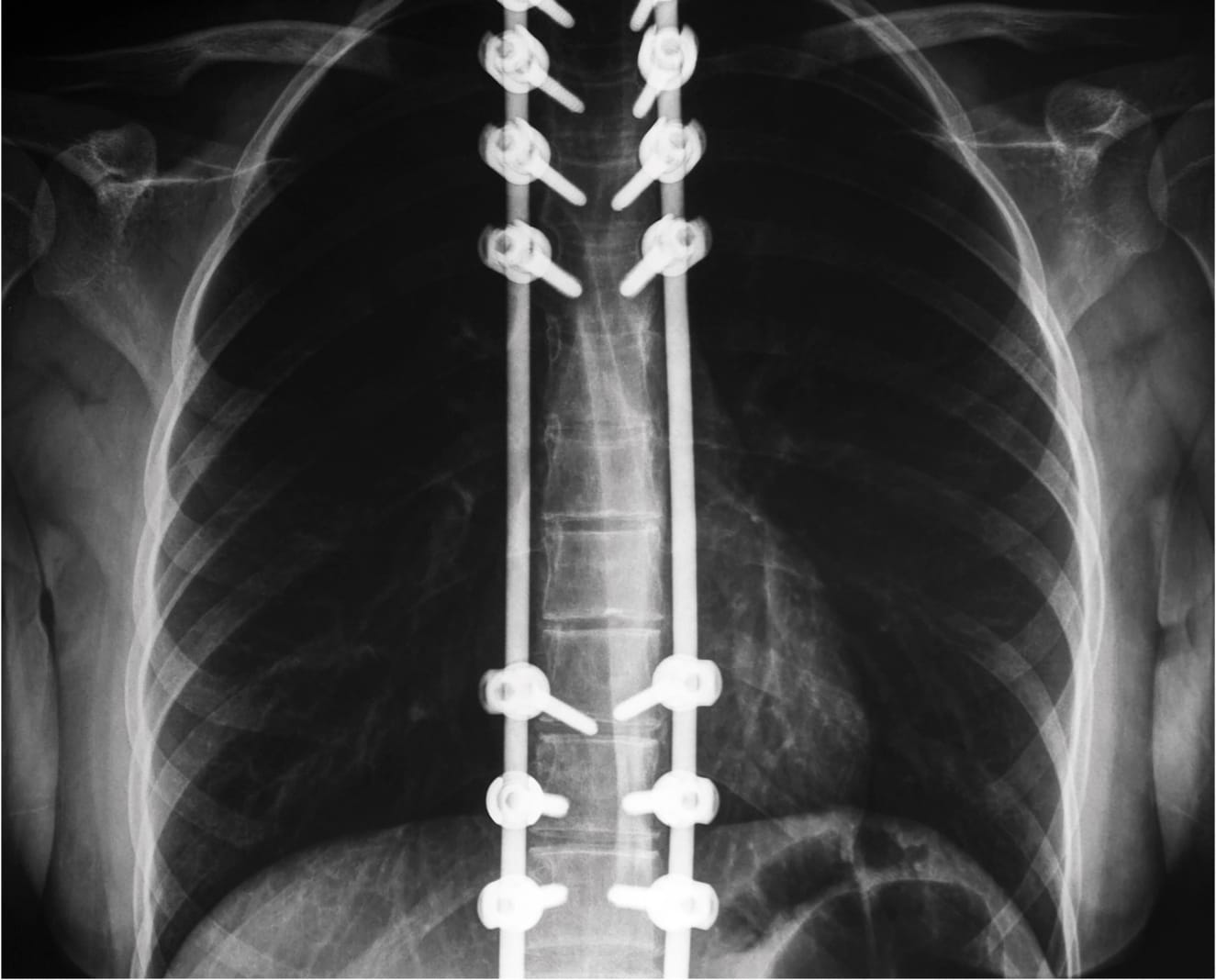 xray