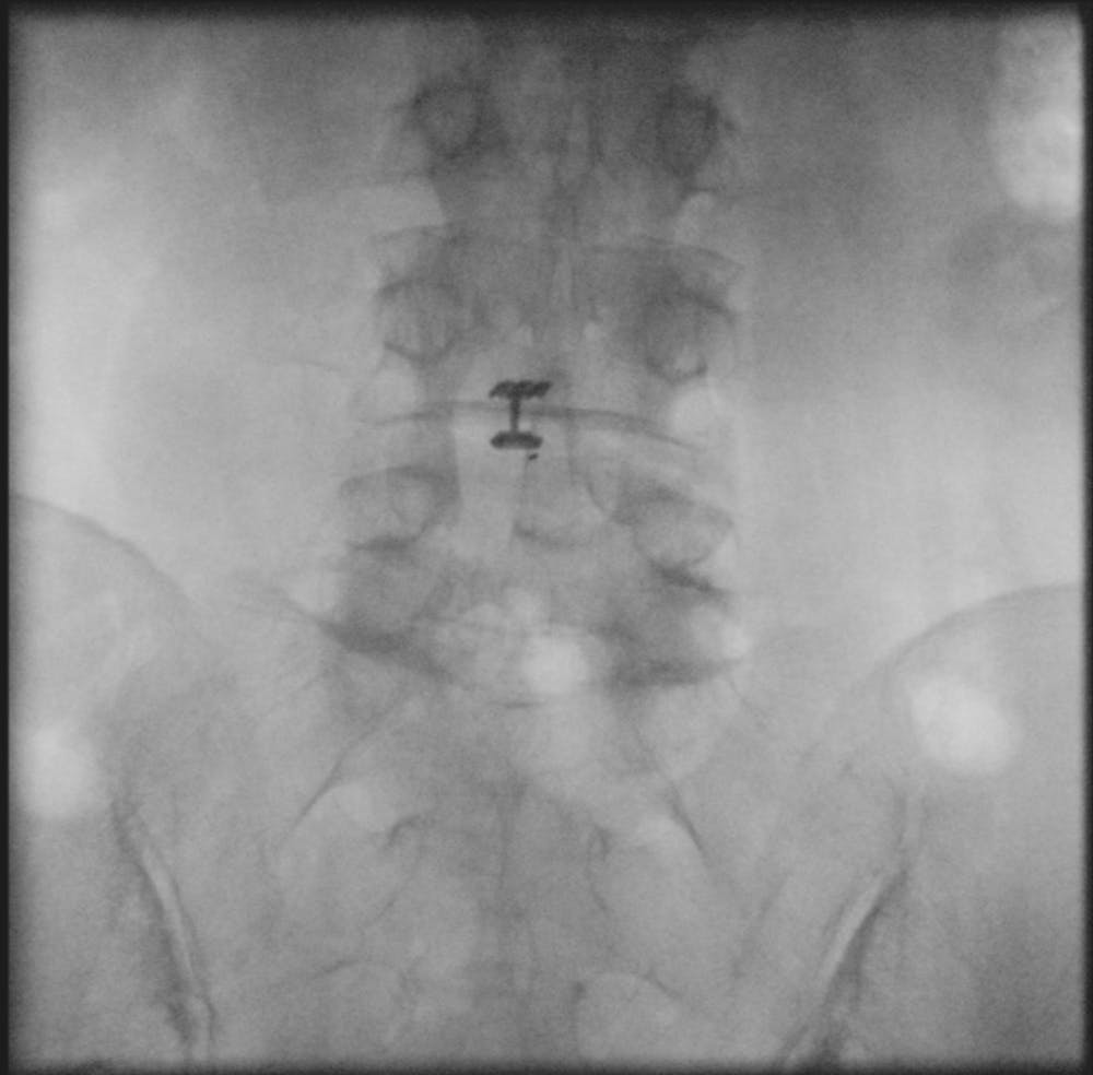 x ray