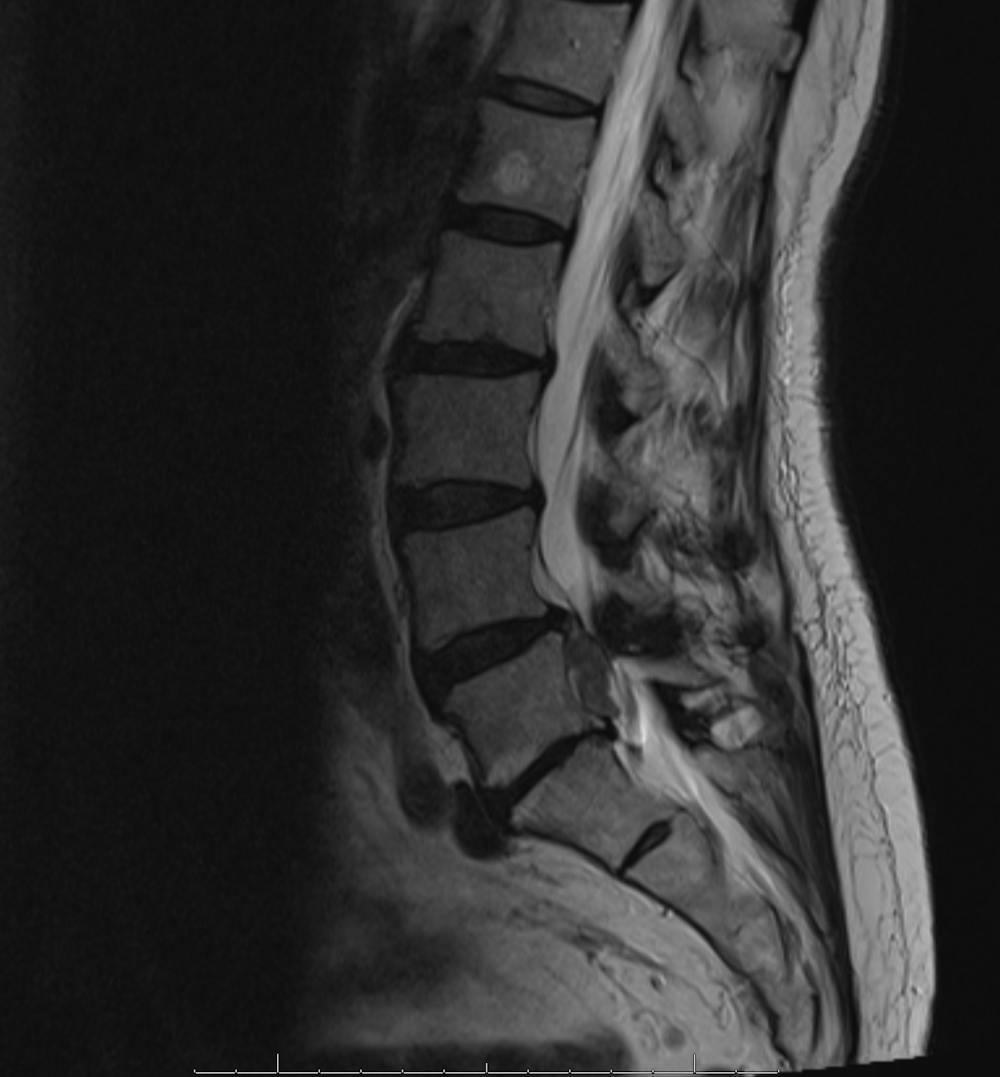 x ray