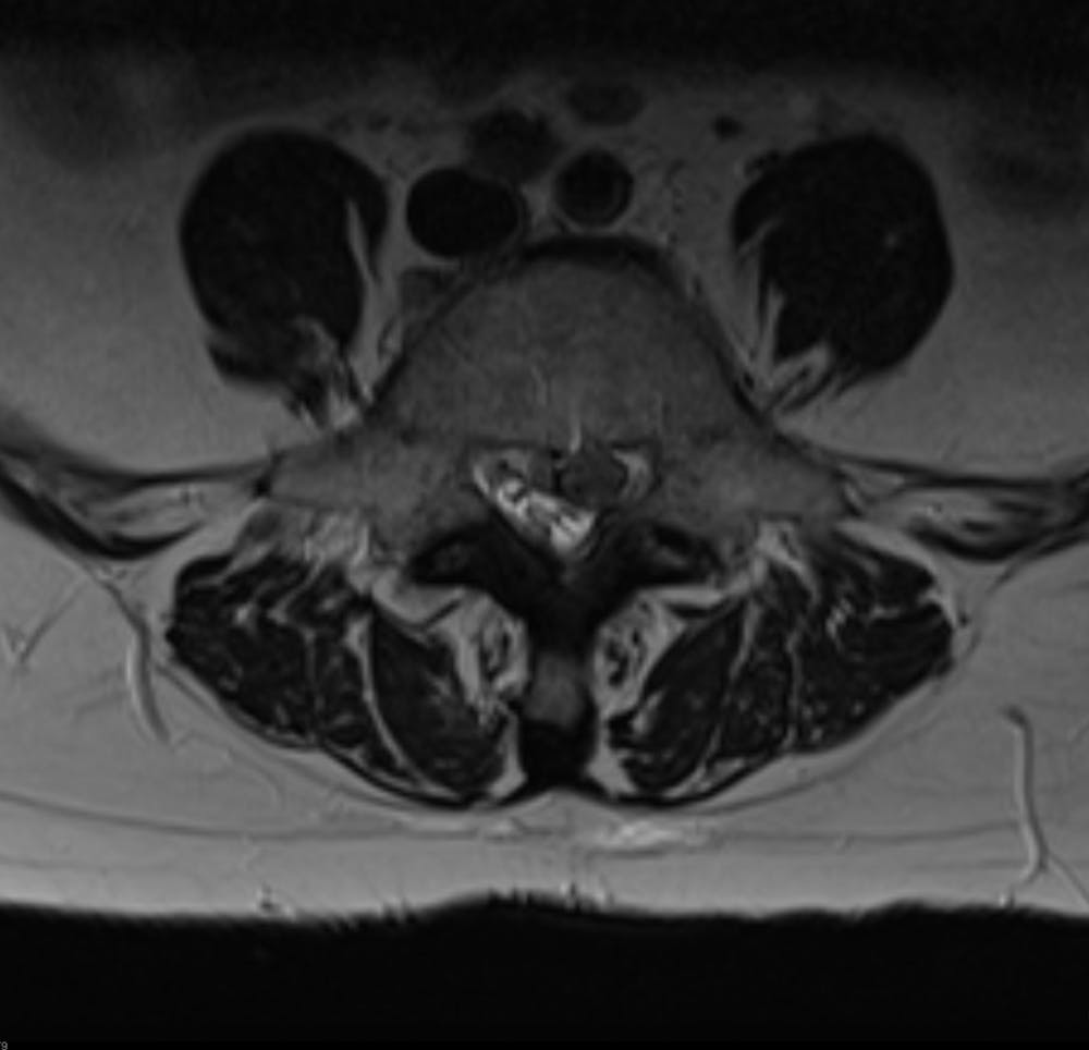 x ray