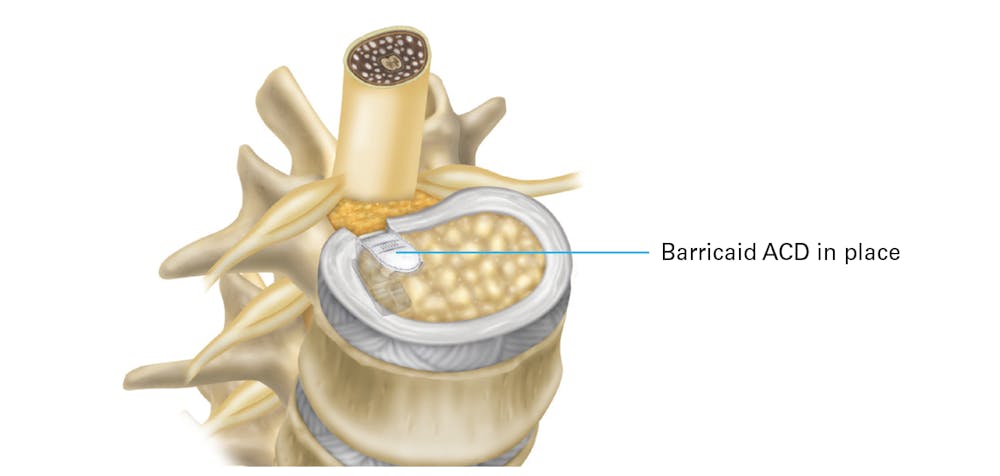 bone infographic