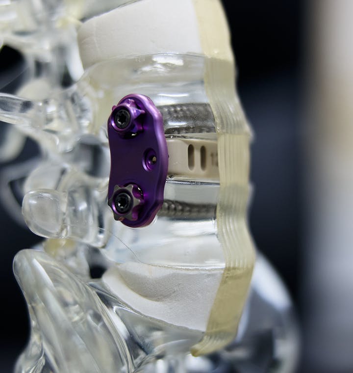 water color painting of an x-ray of a shoulder