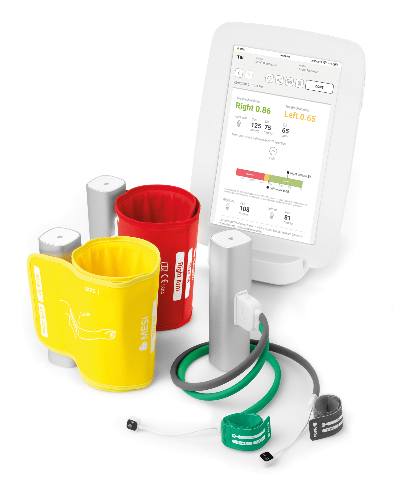 ¡MEDICIÓN AUTOMATIZADA DEL ÍNDICE TOBILLO-BRAZO EN MINUTOS!