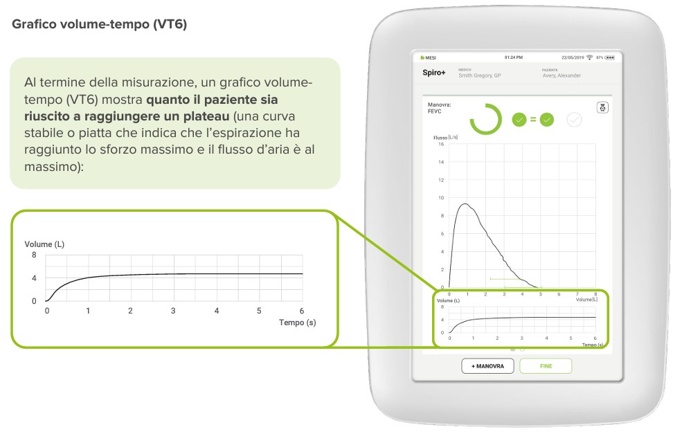 Grafico volume tempo VT6