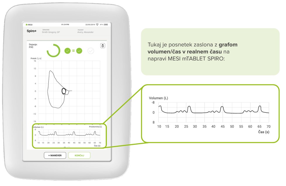 Graf volumen/čas v realnem času