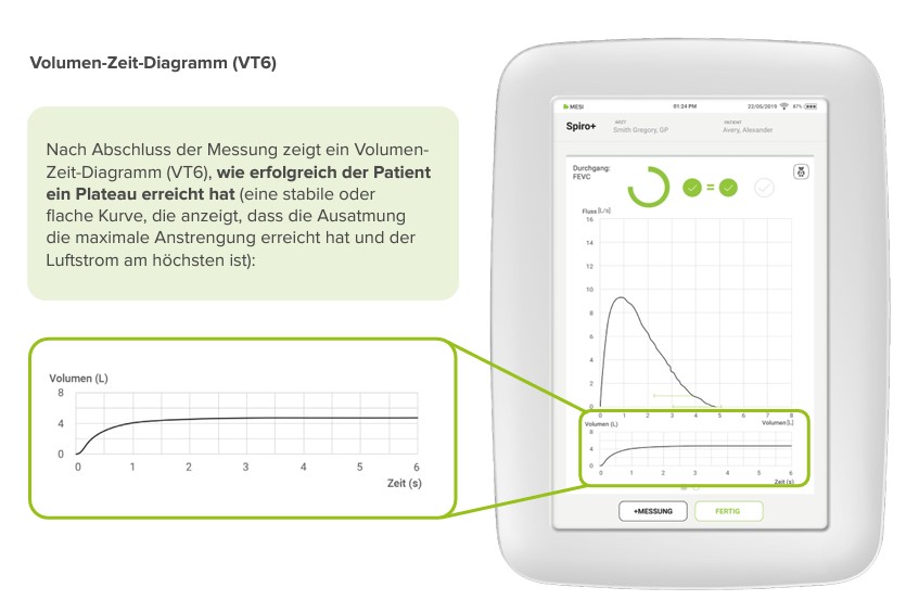 volumen zeit diagramm-vt6