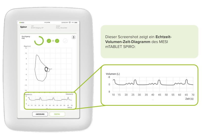 Echtzeit-Volumen-Zeit-Diagramm