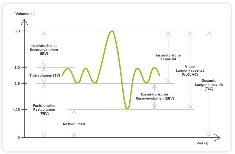 Echtzeit-Volumen-Zeit-Diagramm