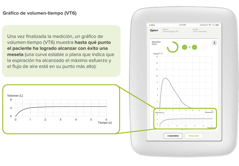 Grafico de volumen tiempo VT6