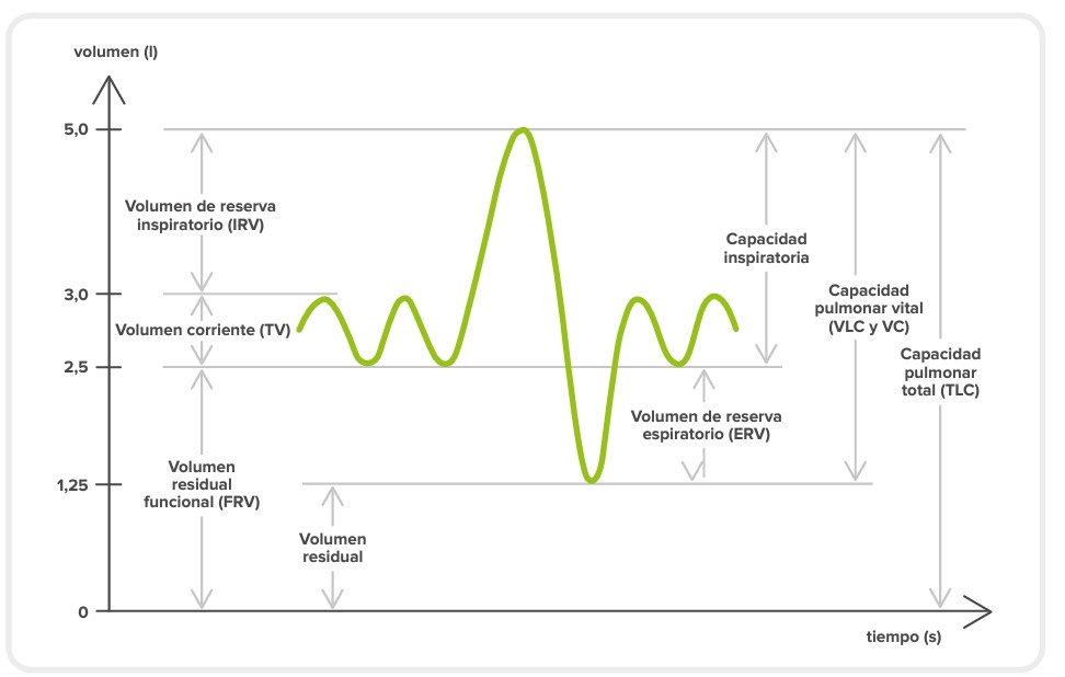 Gráfico de volumen-tiempo en tiempo real