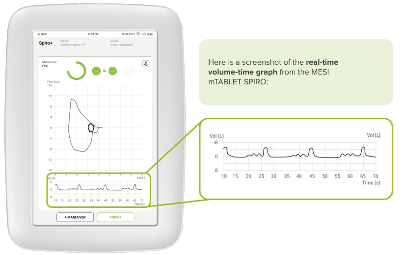 Real-time volume-time graph