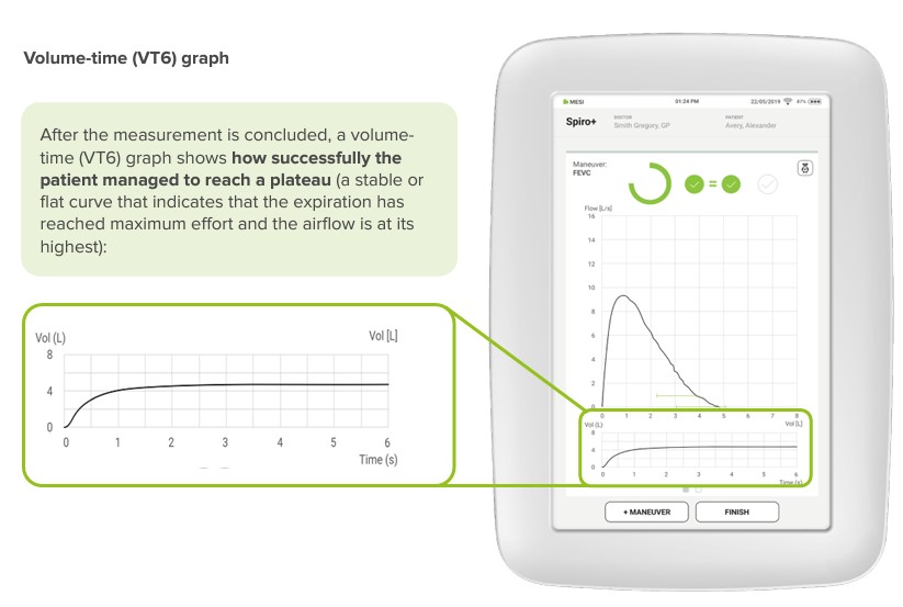 Volume time VT6 graph