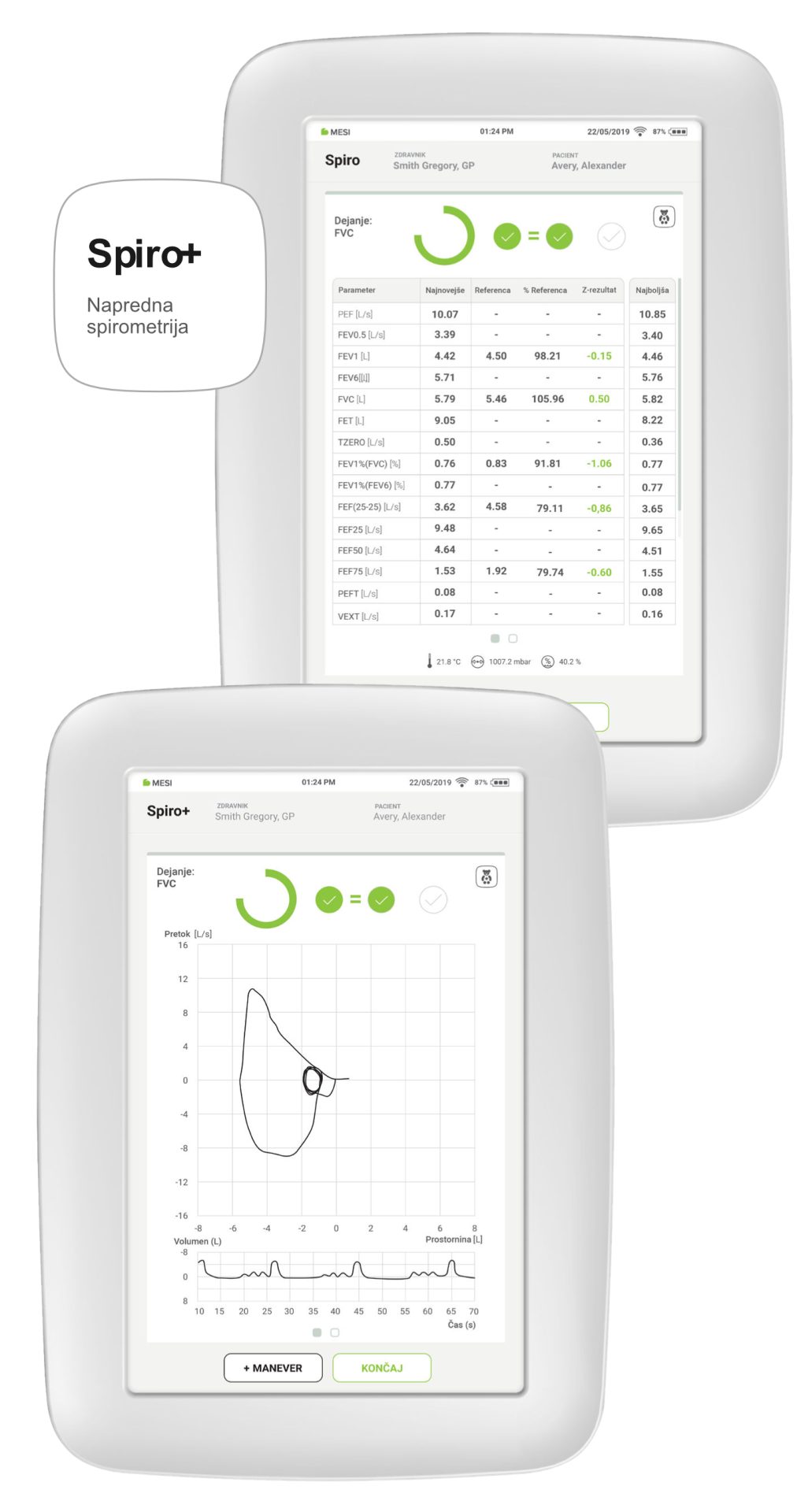 Spiro+ (Napredna spirometrija)