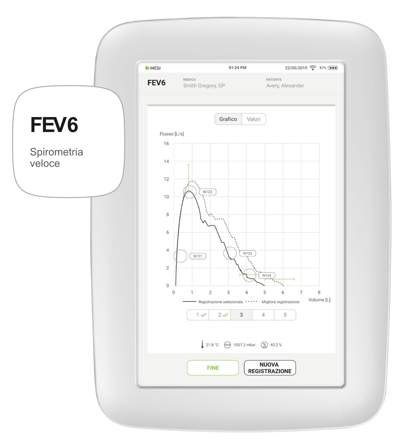 FEV6 (Spirometria Veloce)