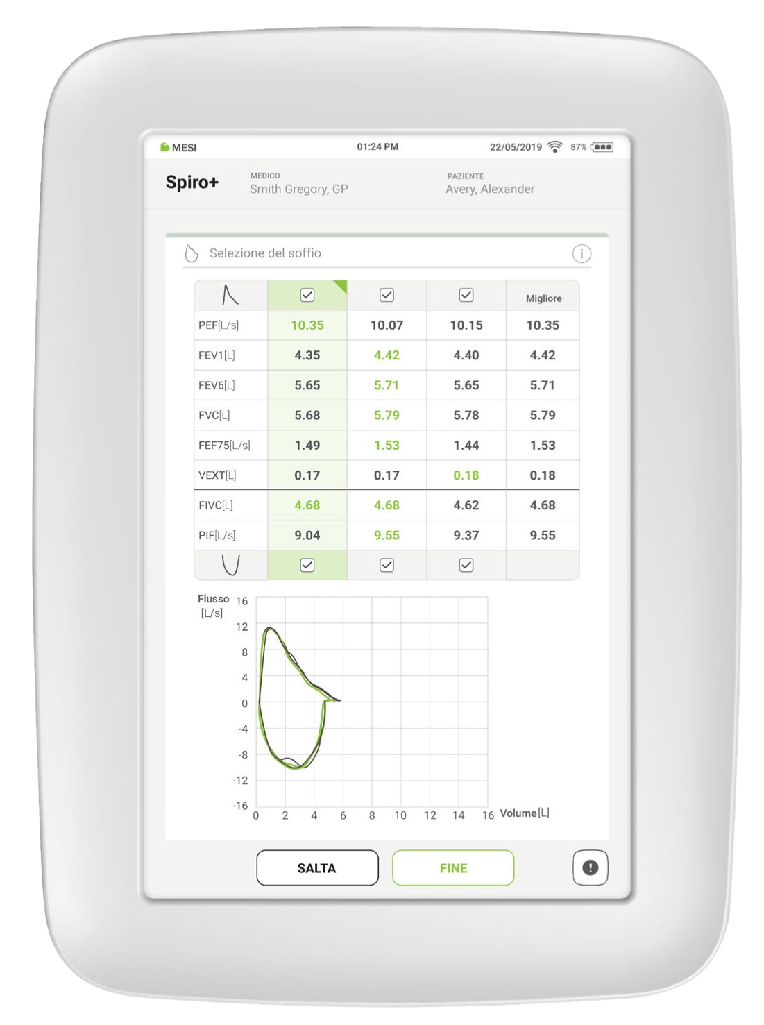 Selezione dei risultati migliori (selezione BestBreath™)