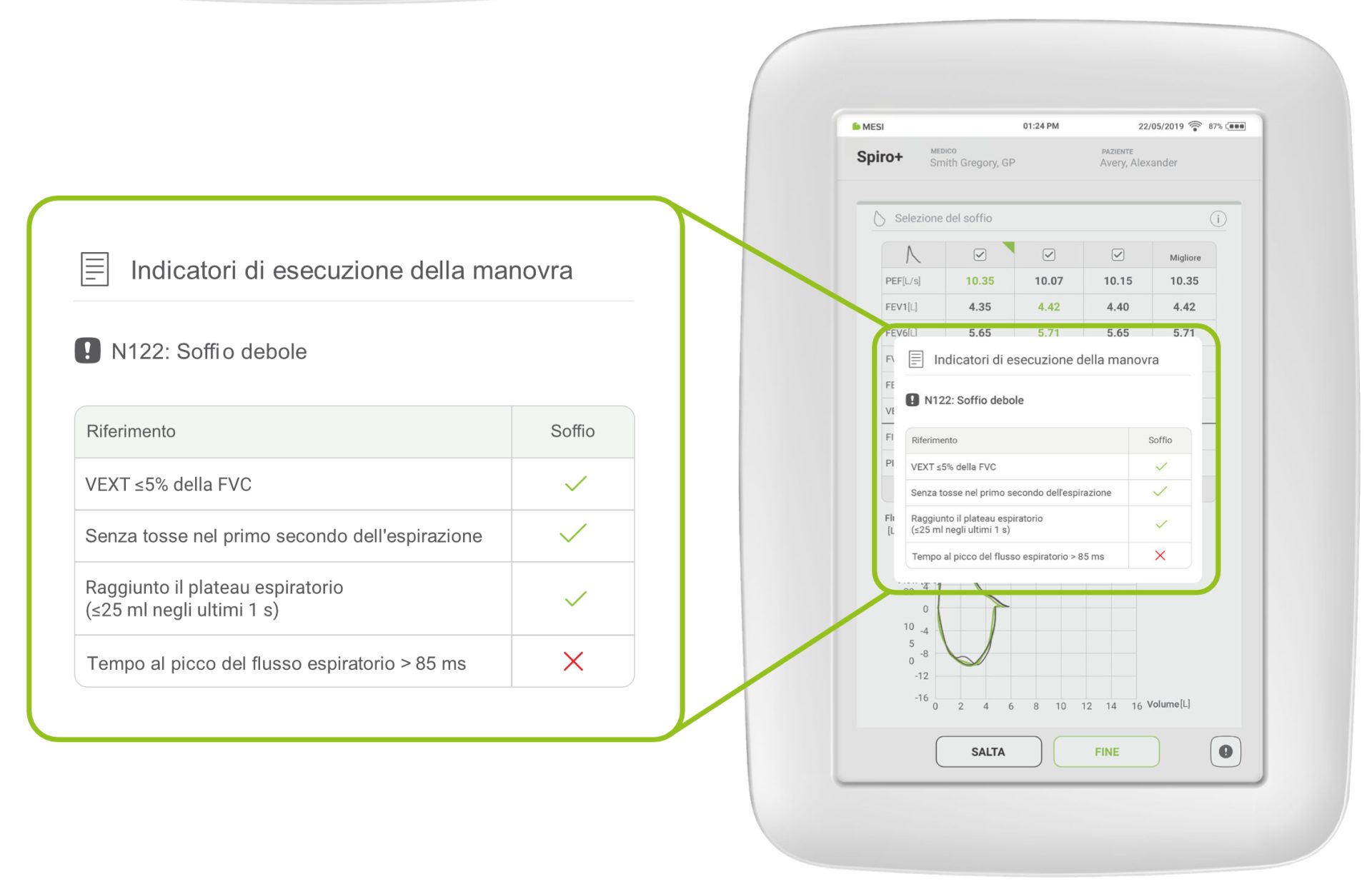 Avvertenze sulla qualità della manovra
