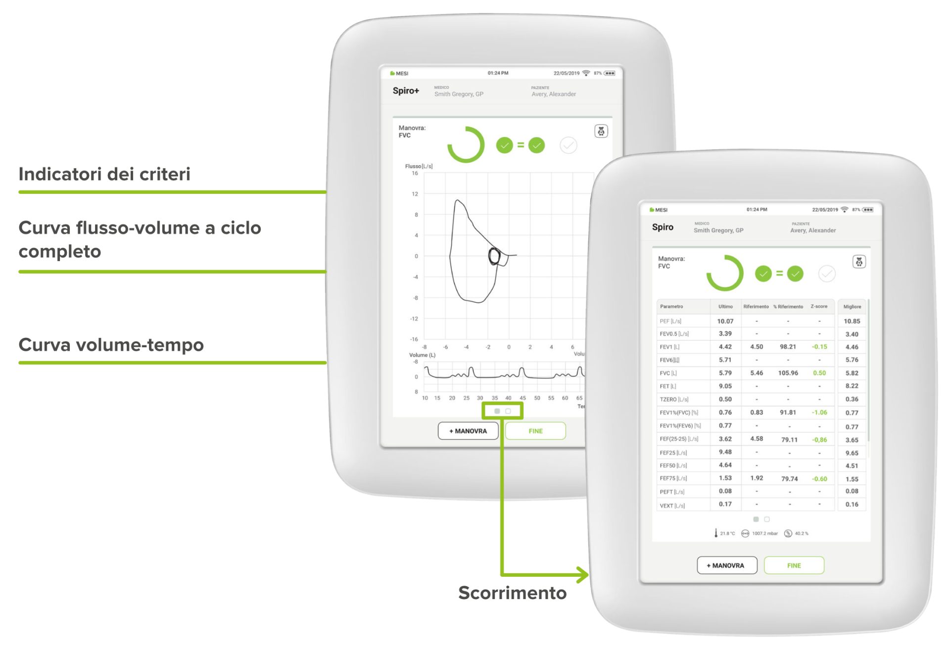 Visualizzazione in tempo reale della curva flusso-volume