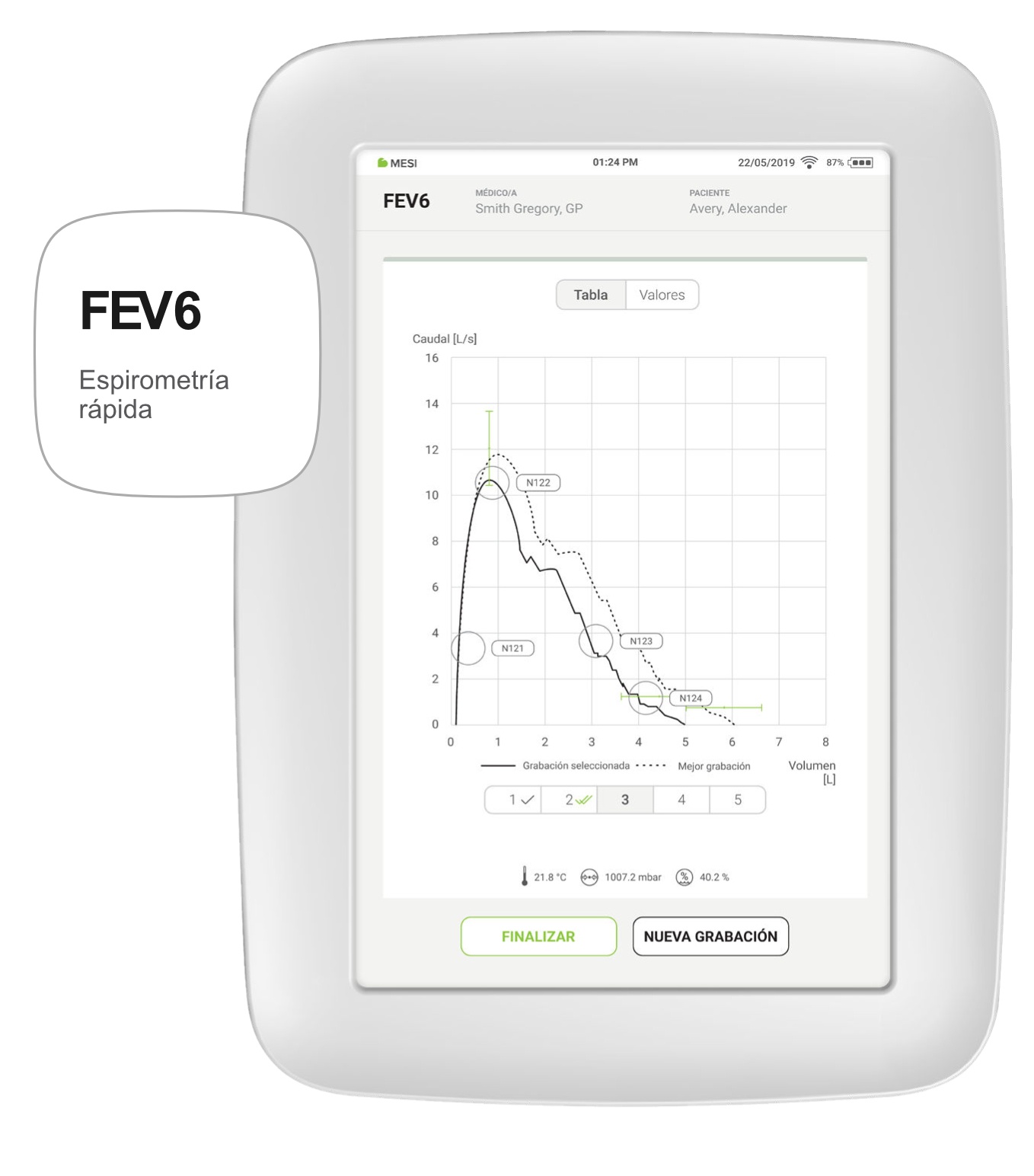 FEV6 Espirometria rapida