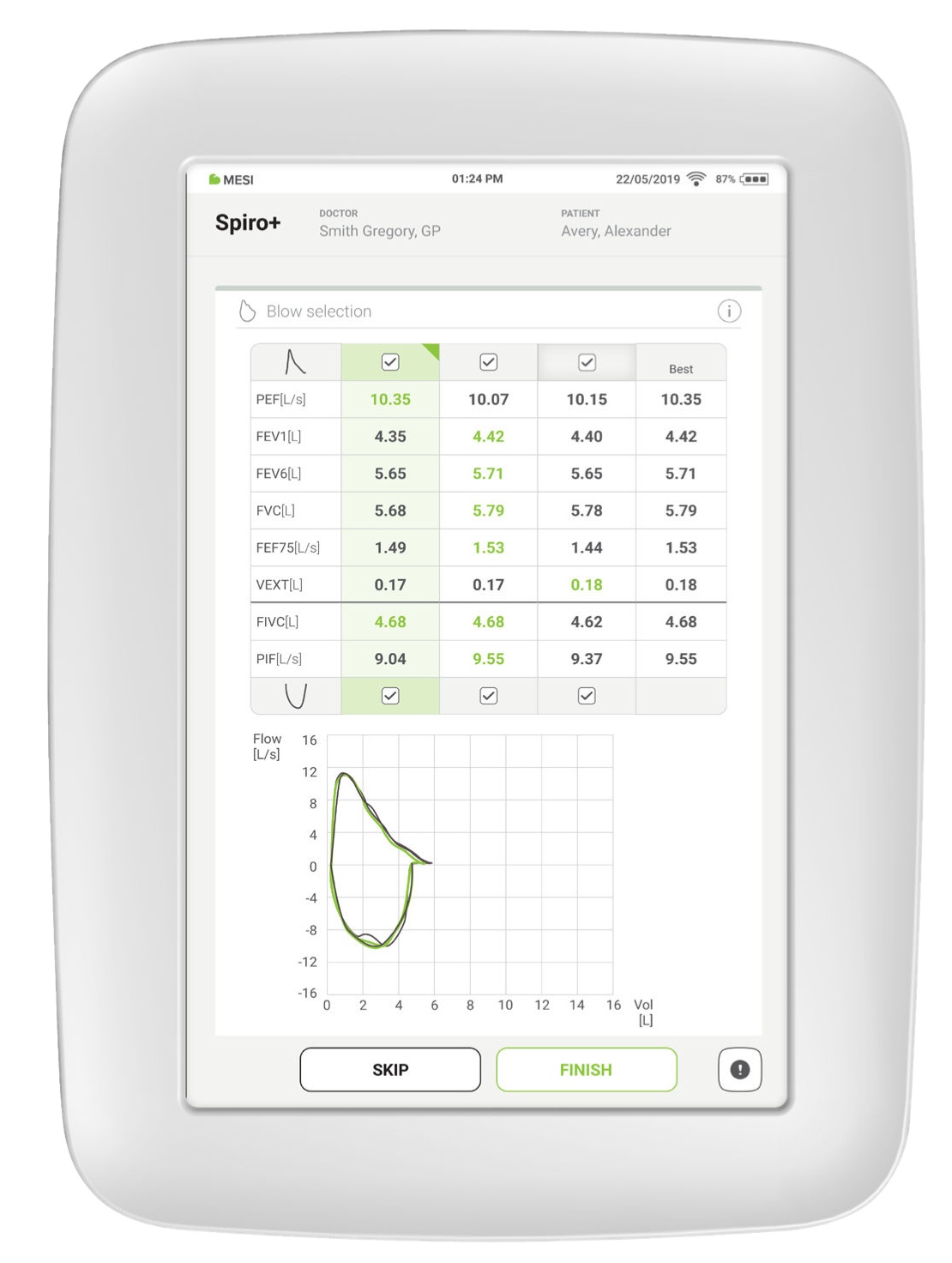 Selección de los mejores resultados (selección de BestBreath™)