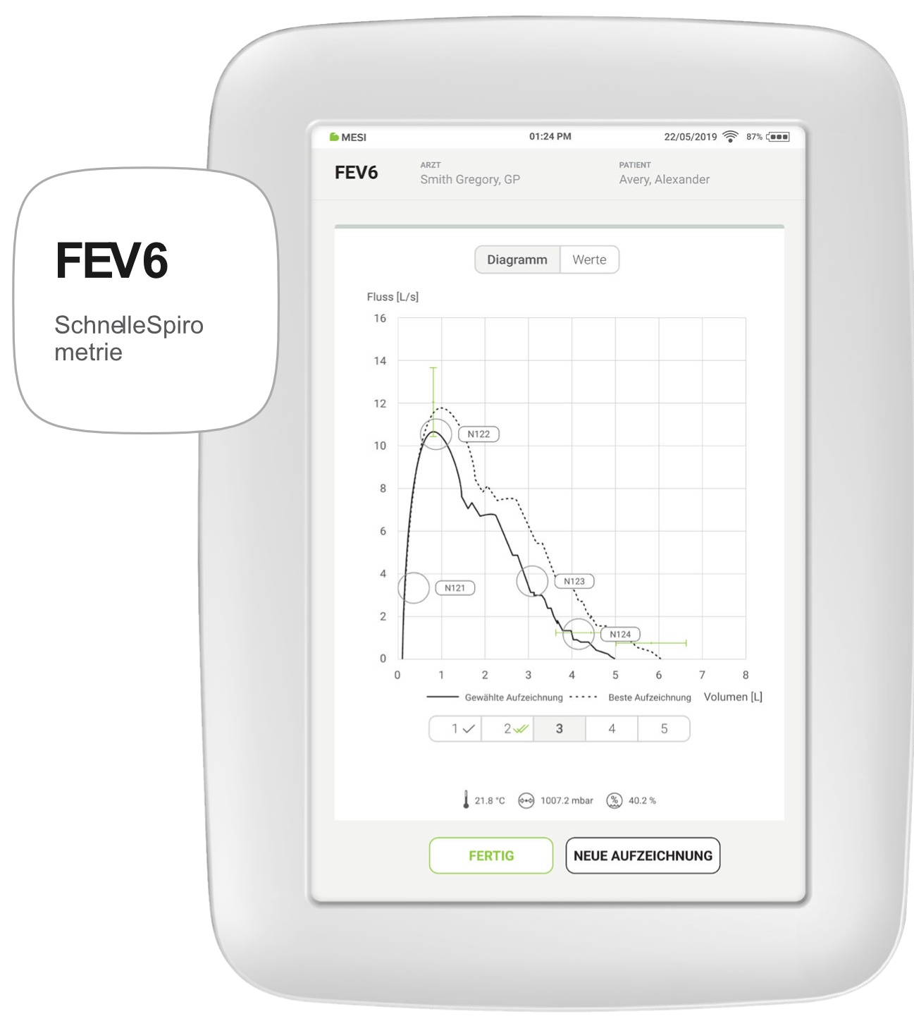 FEV6 Schnelle Spirometrie