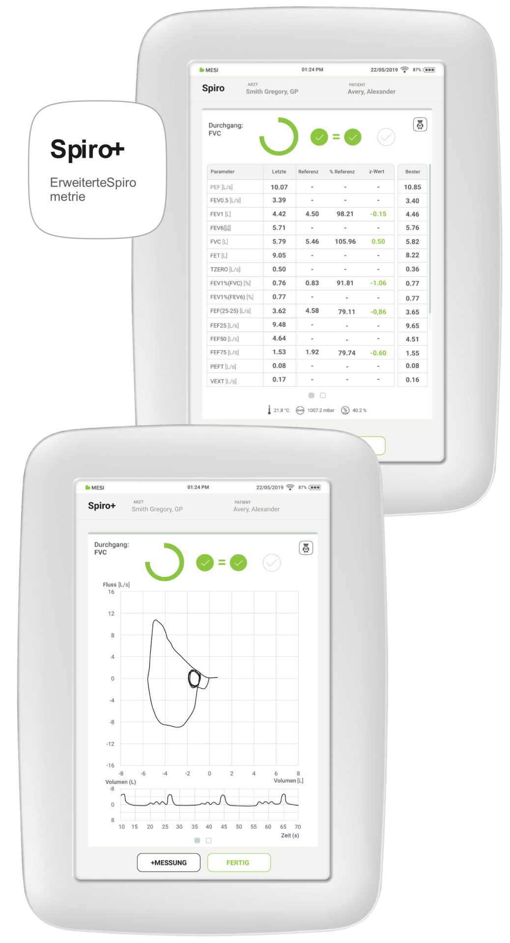 Spiro+ (Erweiterte Spirometrie)Automatische Kalibrierung