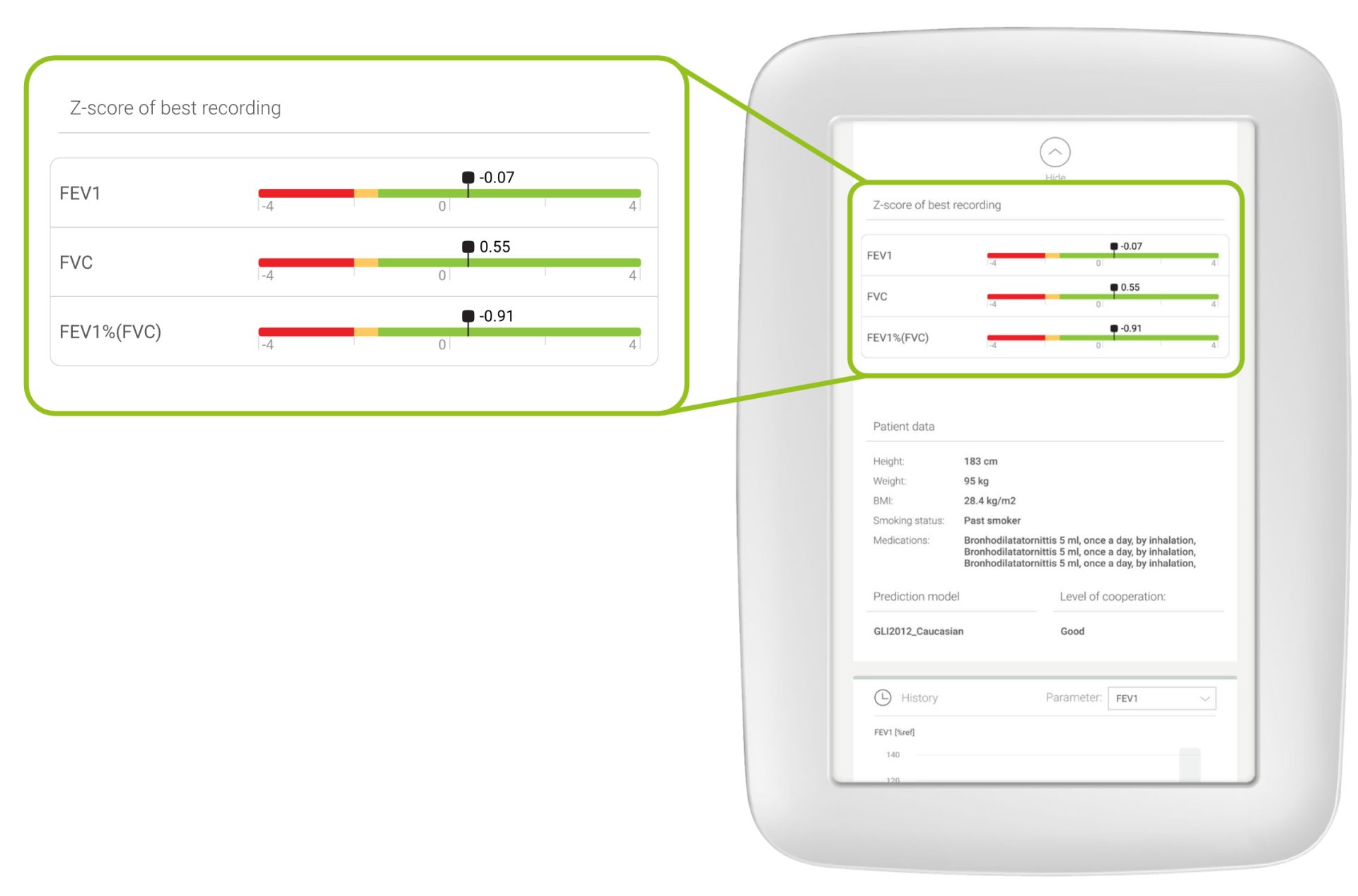 MESI mTABLET SPIRO, the Z-score