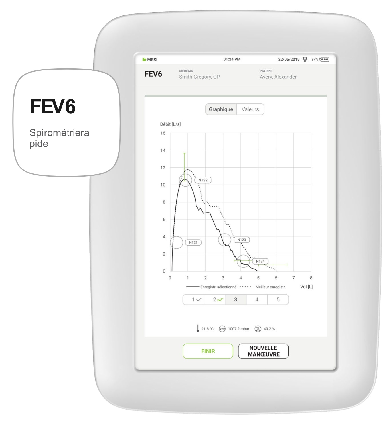FEV6 Spirometrie rapide