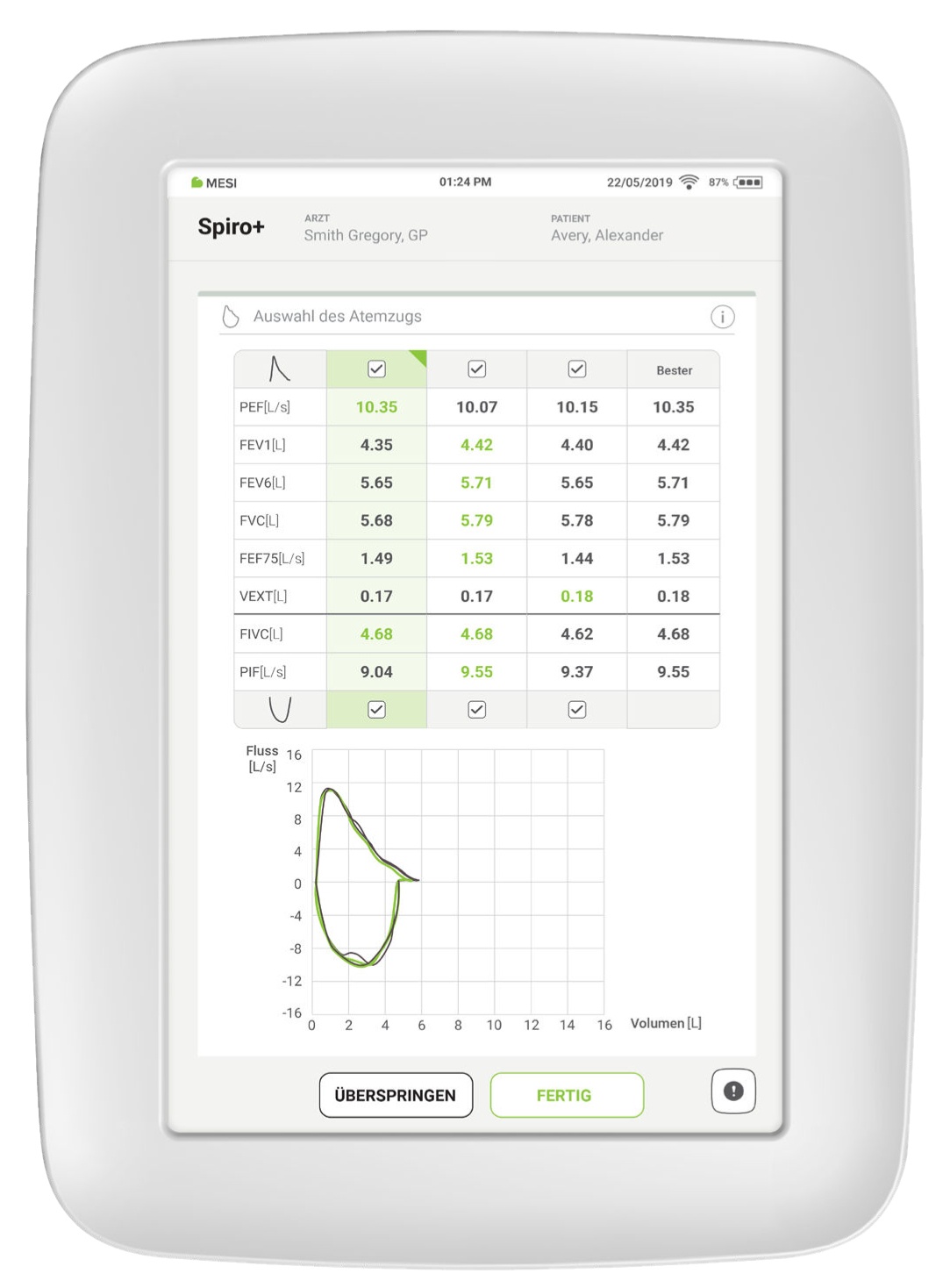 Sélection des meilleurs résultats (sélection BestBreath™)