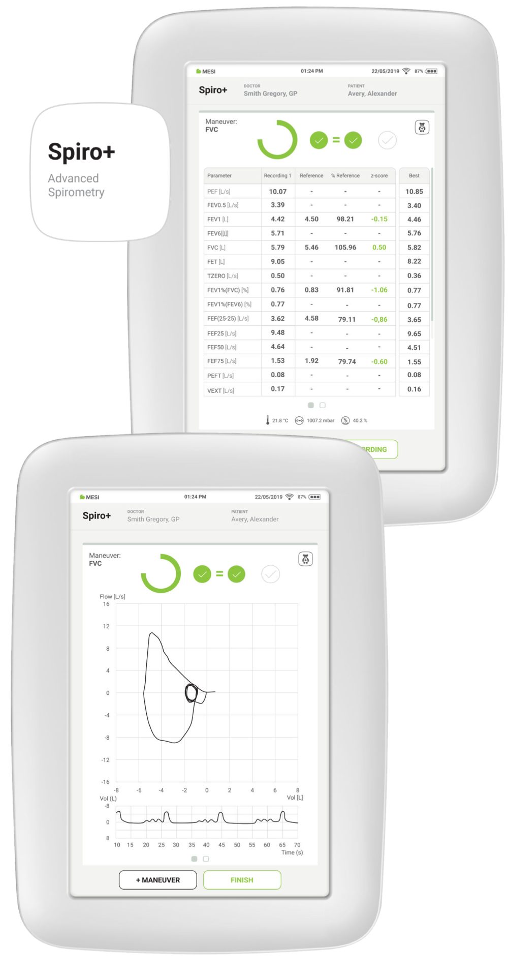 Spiro+ (Advanced Spirometry)