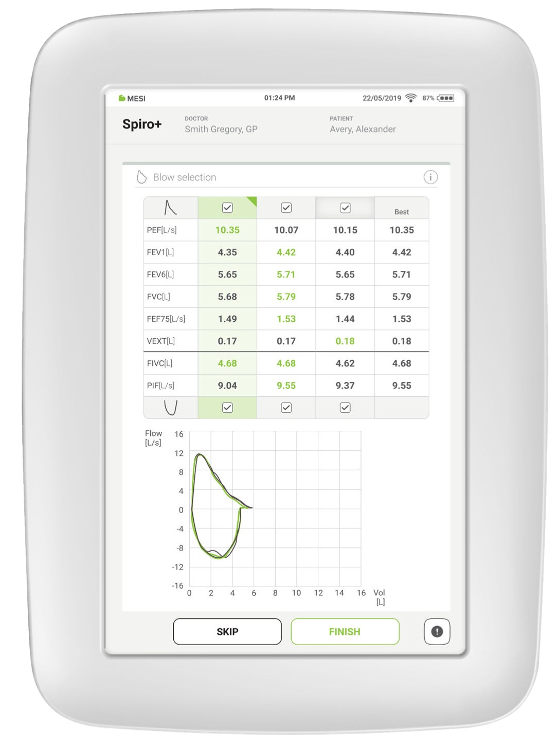 Selection of best results (BestBreath™ selection)