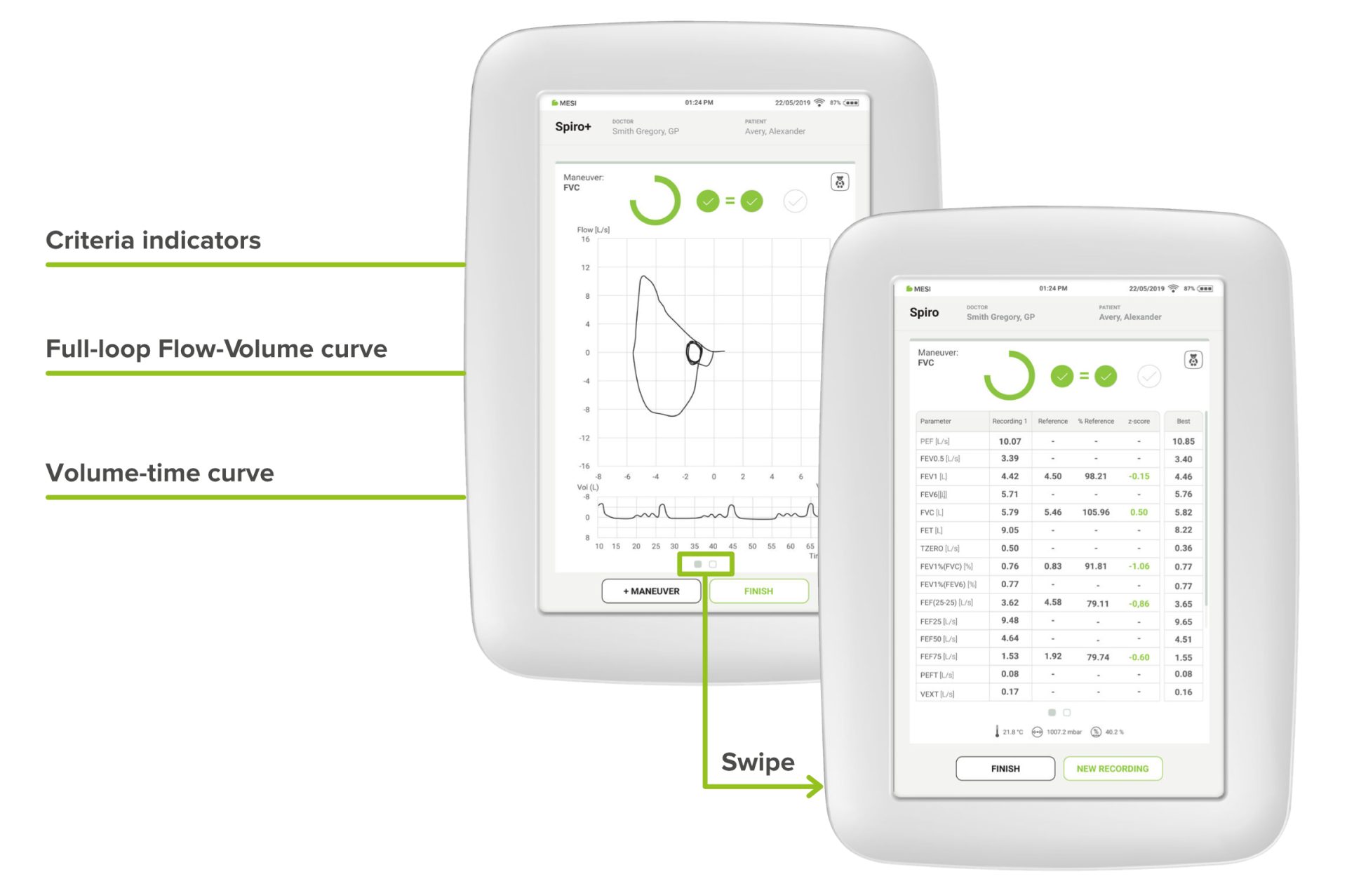 Real-time display of the flow-volume curve