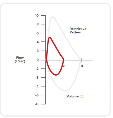 Restrictive conditions