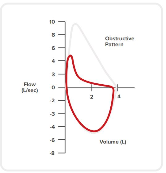 Obstructive conditions
