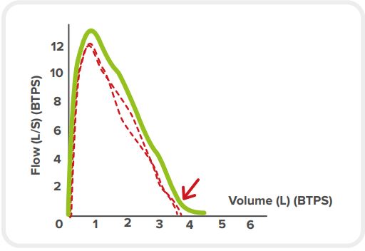 N124-Early-termination