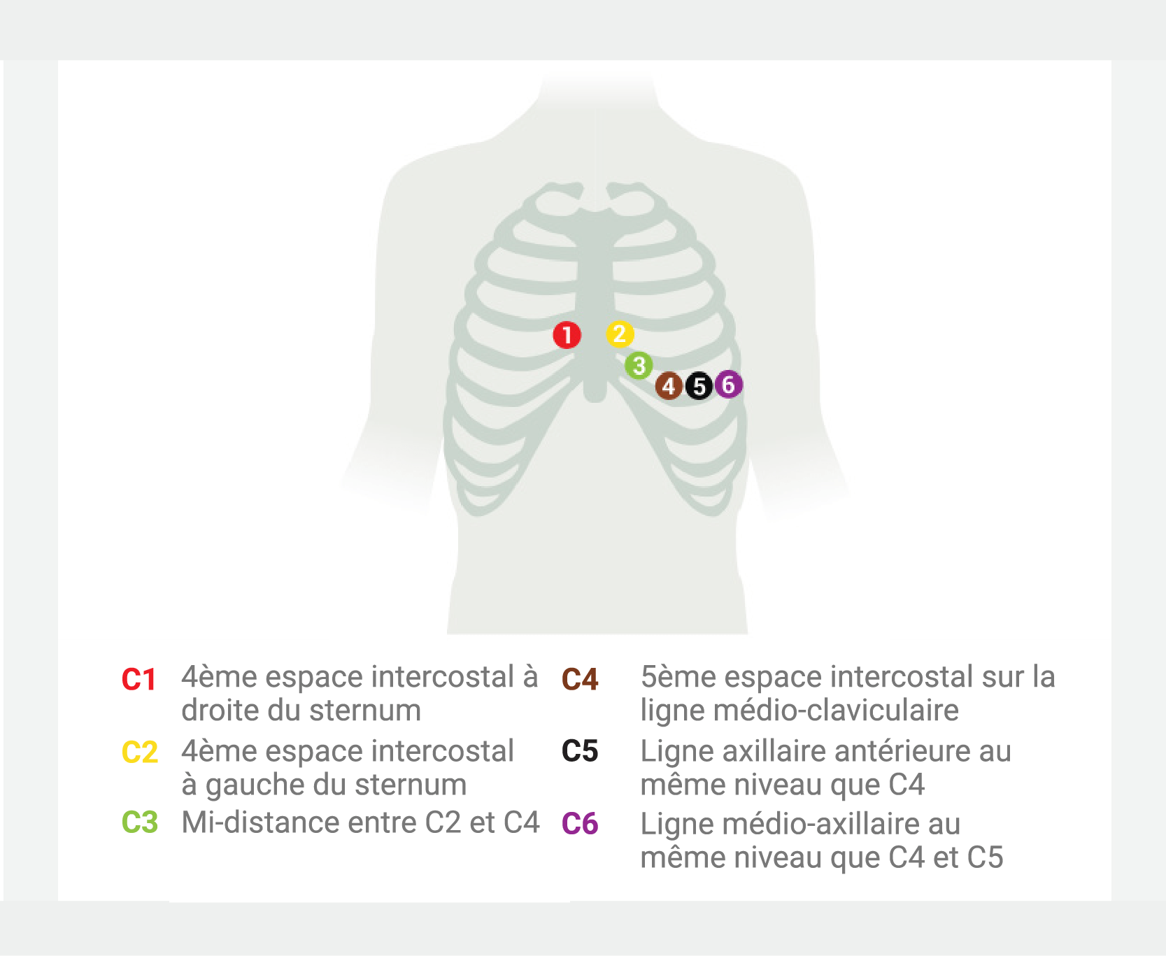 Préparation du patient en cas d’utilisation d’électrodes à aspiration